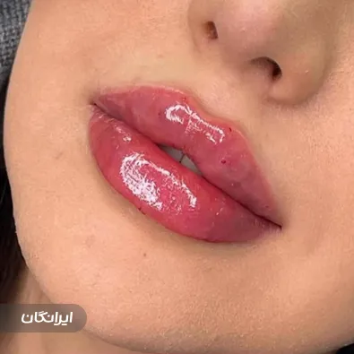 کلینیک زیبایی نایس