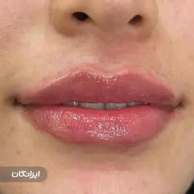 کلینیک زیبایی دکتر شورا شفیق نیا