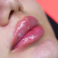 کلینیک زیبایی دایا