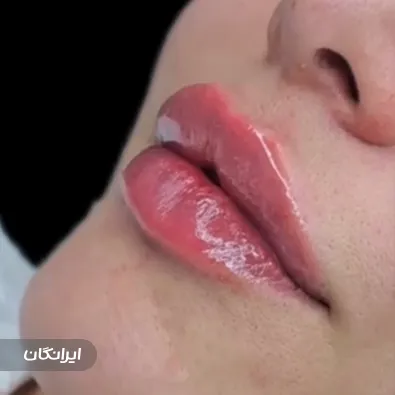 کلینیک زیبایی دکتر سعید شاه قلیان