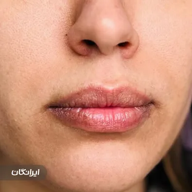 کلینیک زیبایی دکتر لیلا موسوی