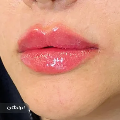 کلینیک زیبایی آیلین