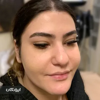 کلینیک زیبایی آیلین