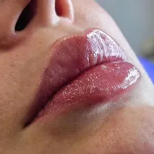 کلینیک زیبایی و لیزر گوهردشت