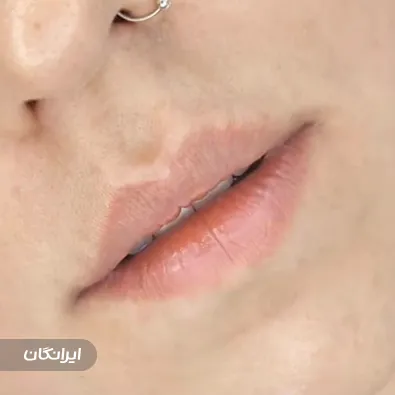 کلینیک زیبایی ارکیده