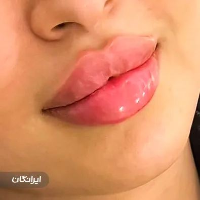 کلینیک زیبایی دکتر لیپ