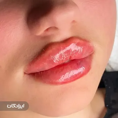 کلینیک زیبایی دکتر لیپ