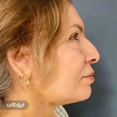 کلینیک زیبایی دکتر علیرضا منوچهری