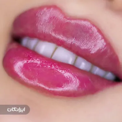 کلینیک زیبایی لوتوس