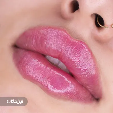 کلینیک زیبایی لوتوس