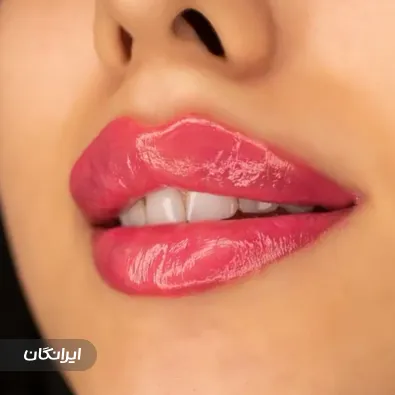 کلینیک زیبایی لوتوس