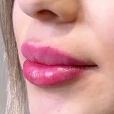 کلینیک زیبایی رویال بیوتی