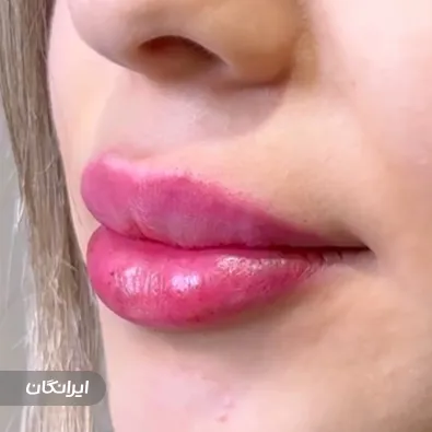 کلینیک زیبایی رویال بیوتی