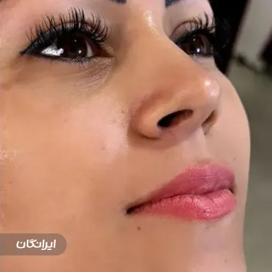 کلینیک زیبایی رویال بیوتی