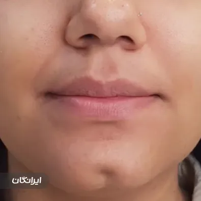 کلینیک زیبایی دکتر نجمه قلزم