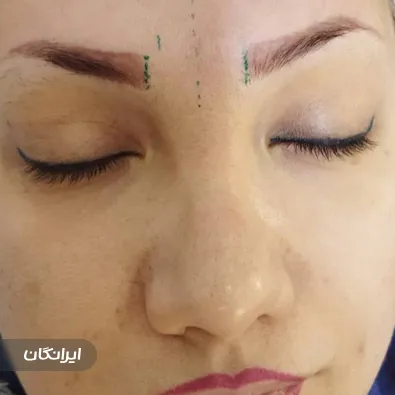 کلینیک زیبایی دریا کاشت