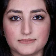 کلینیک زیبایی بیوتی ساپورت