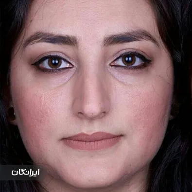 کلینیک زیبایی بیوتی ساپورت