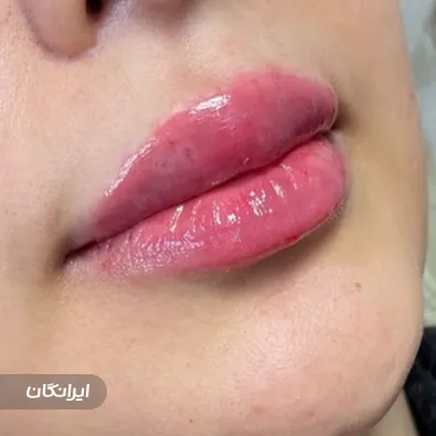 کلینیک زیبایی دکتر ملیسا دیبامهر