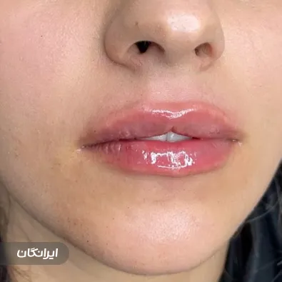 کلینیک زیبایی هانی