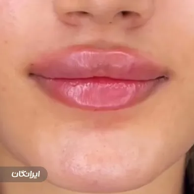 کلینیک زیبایی هانی