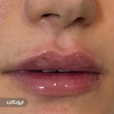 کلینیک زیبایی دکتر رویا تیرانداز