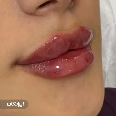 کلینیک زیبایی دکتر رویا تیرانداز