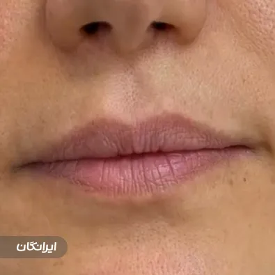 کلینیک زیبایی دکتر رویا تیرانداز