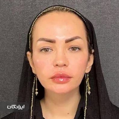 کلینیک زیبایی دکتر فاطمه حسن زاده رستمی