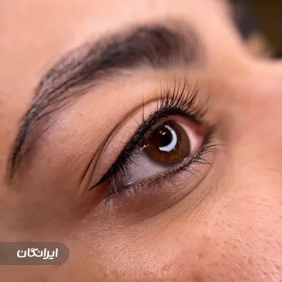 کلینیک زیبایی بهار