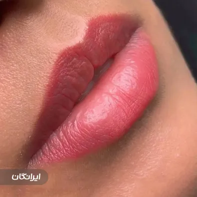 کلینیک زیبایی بهار