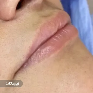 کلینیک زیبایی پارسیان