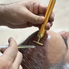 کلینیک زیبایی واران کاشت