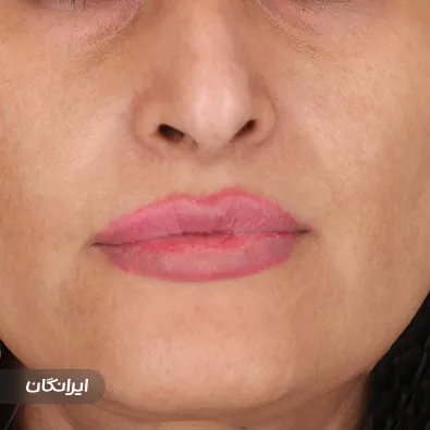 کلینیک زیبایی دکتر سوسن احمدی