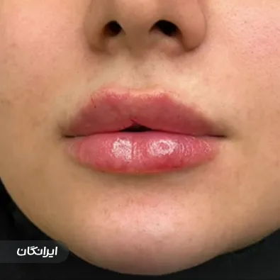 کلینیک زیبایی تیولیپ