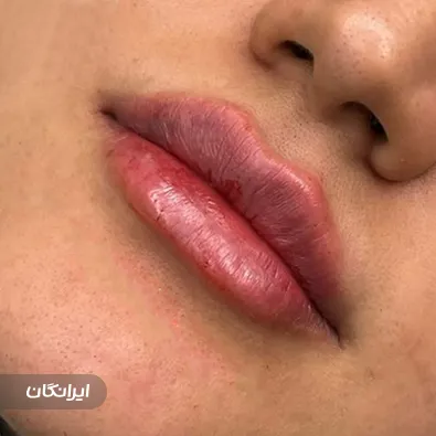 کلینیک زیبایی تیولیپ