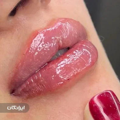 کلینیک زیبایی مرسی