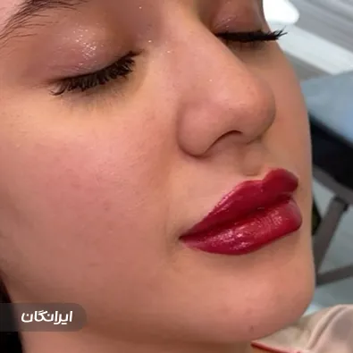 کلینیک زیبایی مرسی