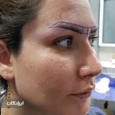 کلینیک زیبایی گلدن فیس