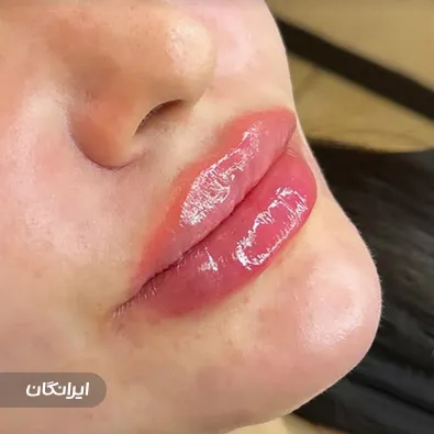 کلینیک زیبایی فرشتگان