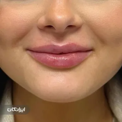 کلینیک زیبایی نگار