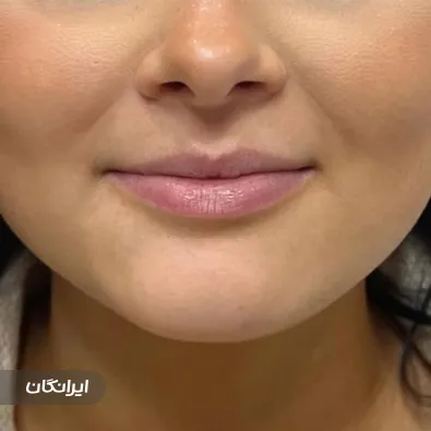 کلینیک زیبایی نگار