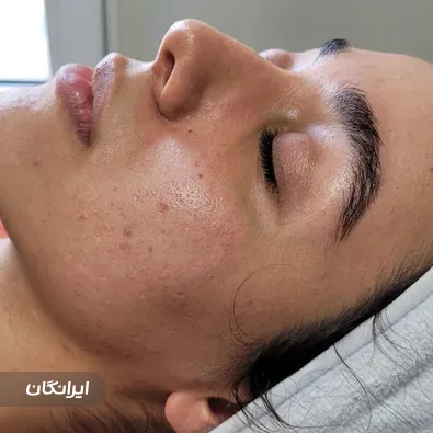 فیشیالیست نیوشا جباری