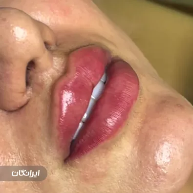 کلینیک زیبایی دکتر شکوه محمدنژاد