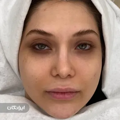 میکاپ آرتیست دنیز حقیقی