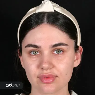 سالن زیبایی آناهید