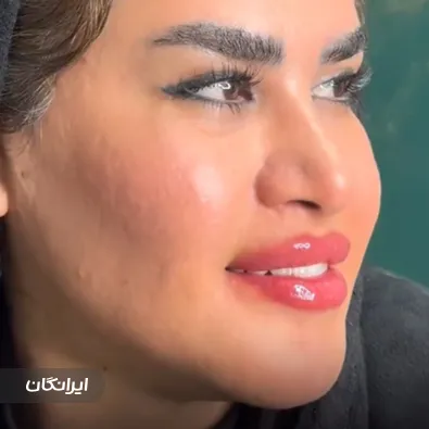 کلینیک زیبایی دکتر عظیم قزوینی