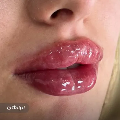 کلینیک زیبایی دکتر عظیم قزوینی