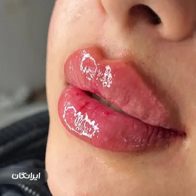 کلینیک زیبایی گلد