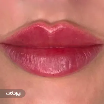 کلینیک زیبایی رز